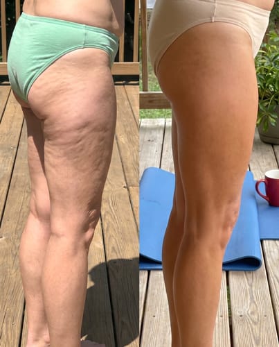 Customer review photo