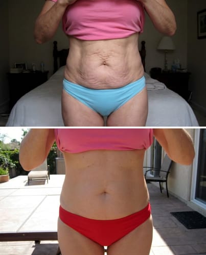 Customer review photo